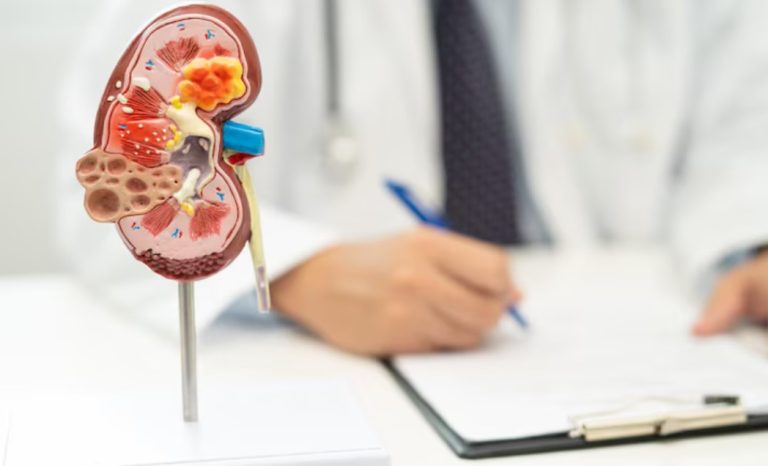 Kidney Treatment in Singapore